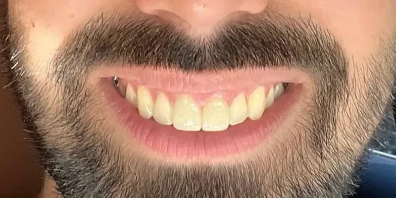 Pines Dental Associates dentists in Pembroke Pines, FL - photo 5